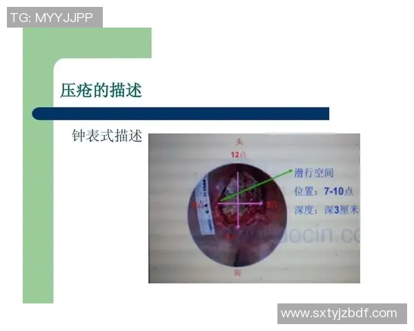 欧塞尔与克维伊对决分析及双方近期状态评估 欧塞尔与克维伊对决分析及双方近期状态评估